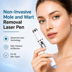 Xorita Laser Mole and Wart Removal Pen