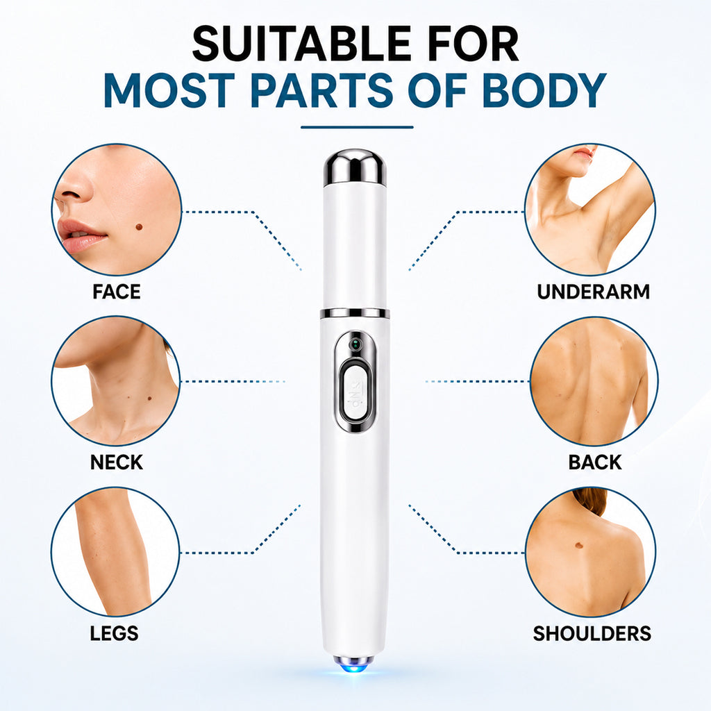 Xorita Laser Mole and Wart Removal Pen