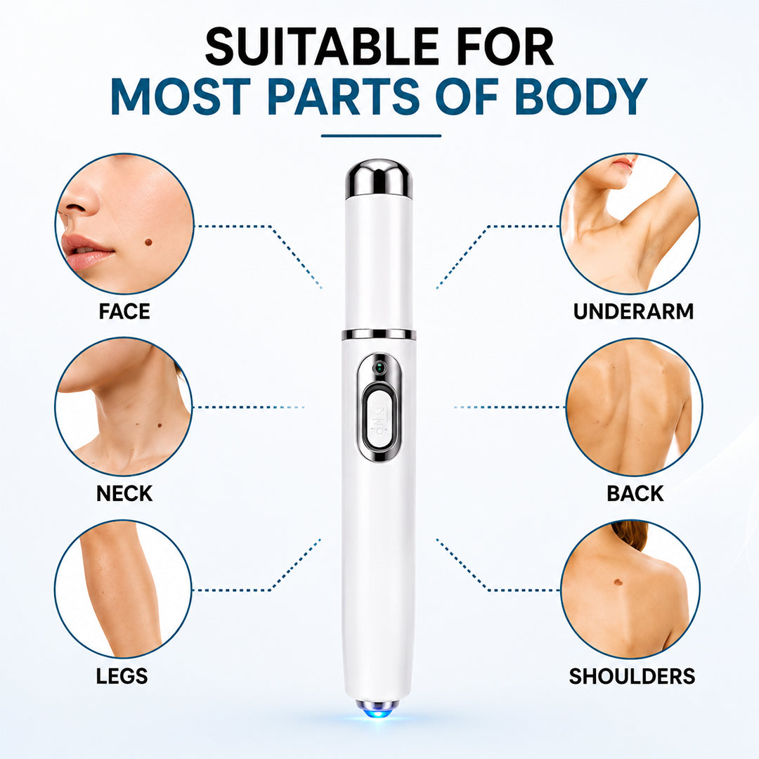 Xorita Laser Mole and Wart Removal Pen