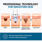 Xorita Laser Mole and Wart Removal Pen