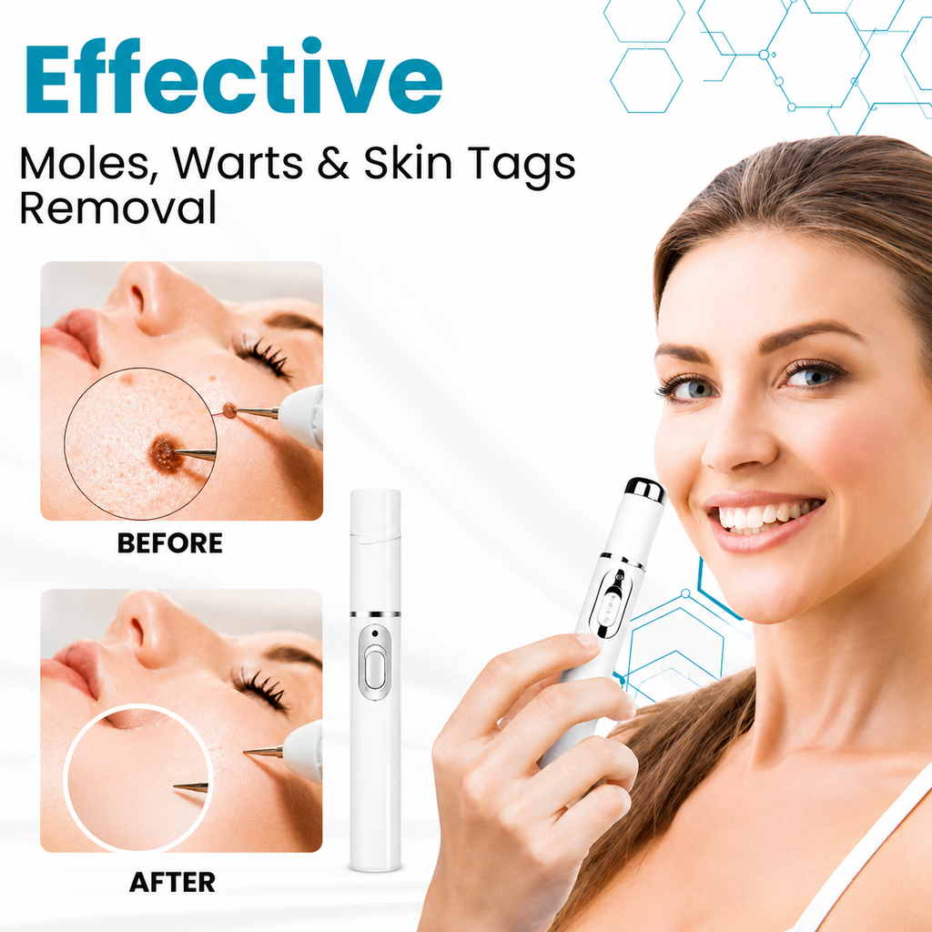 Xorita Laser Mole and Wart Removal Pen
