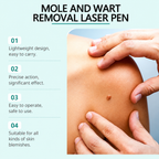 Xorita Laser Mole and Wart Removal Pen